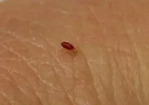 Baby Bed Bugs