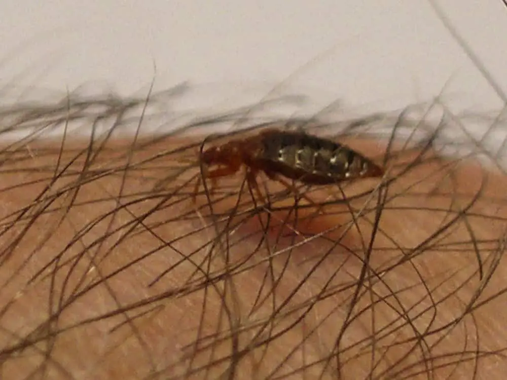Bed Bugs in Hair
