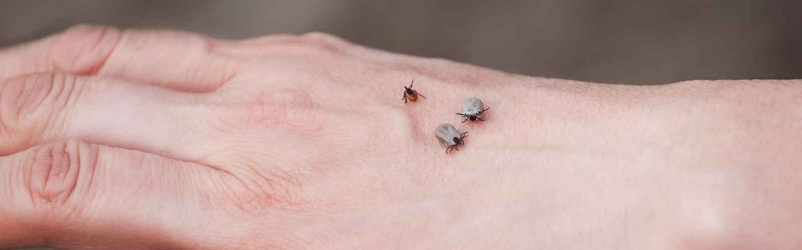 Types of Fleas Complete Guide!