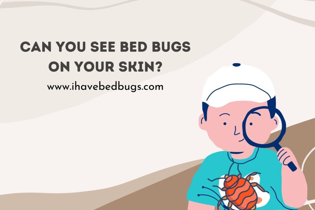 Can You See Bed Bugs on Your Skin?